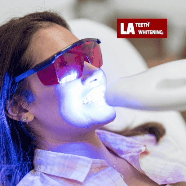 Contact LA Teeth Whitening Today! Book your appointment!Contact LA Teeth Whitening Today! Book your appointment! Brackley