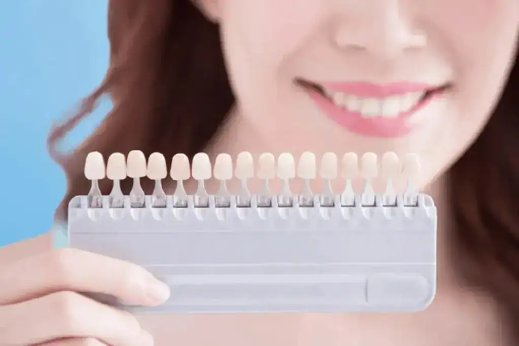 At-Home vs In-Clinic Whitening: Why Professional Laser Wins Brackley