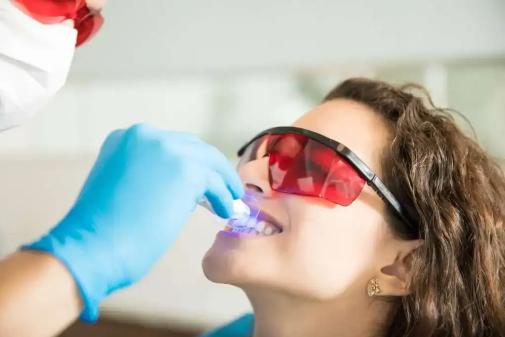Laser Teeth Whitening FAQs Brackley &ndash; Your Ultimate Guide Brackley
