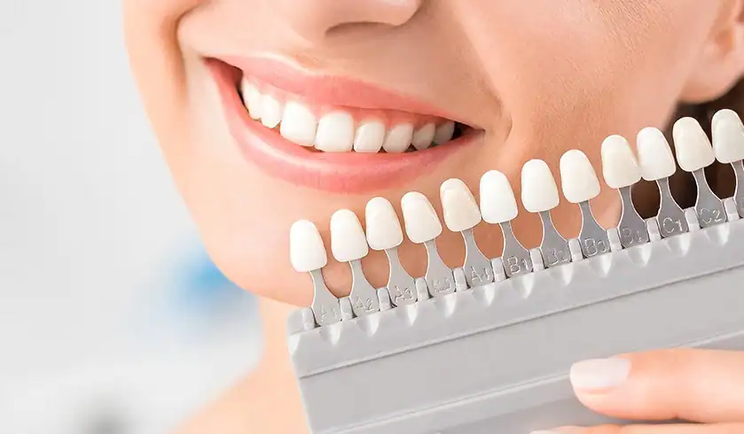 How Can You Tell When It&rsquo;s Time for a Touch-Up Brackley